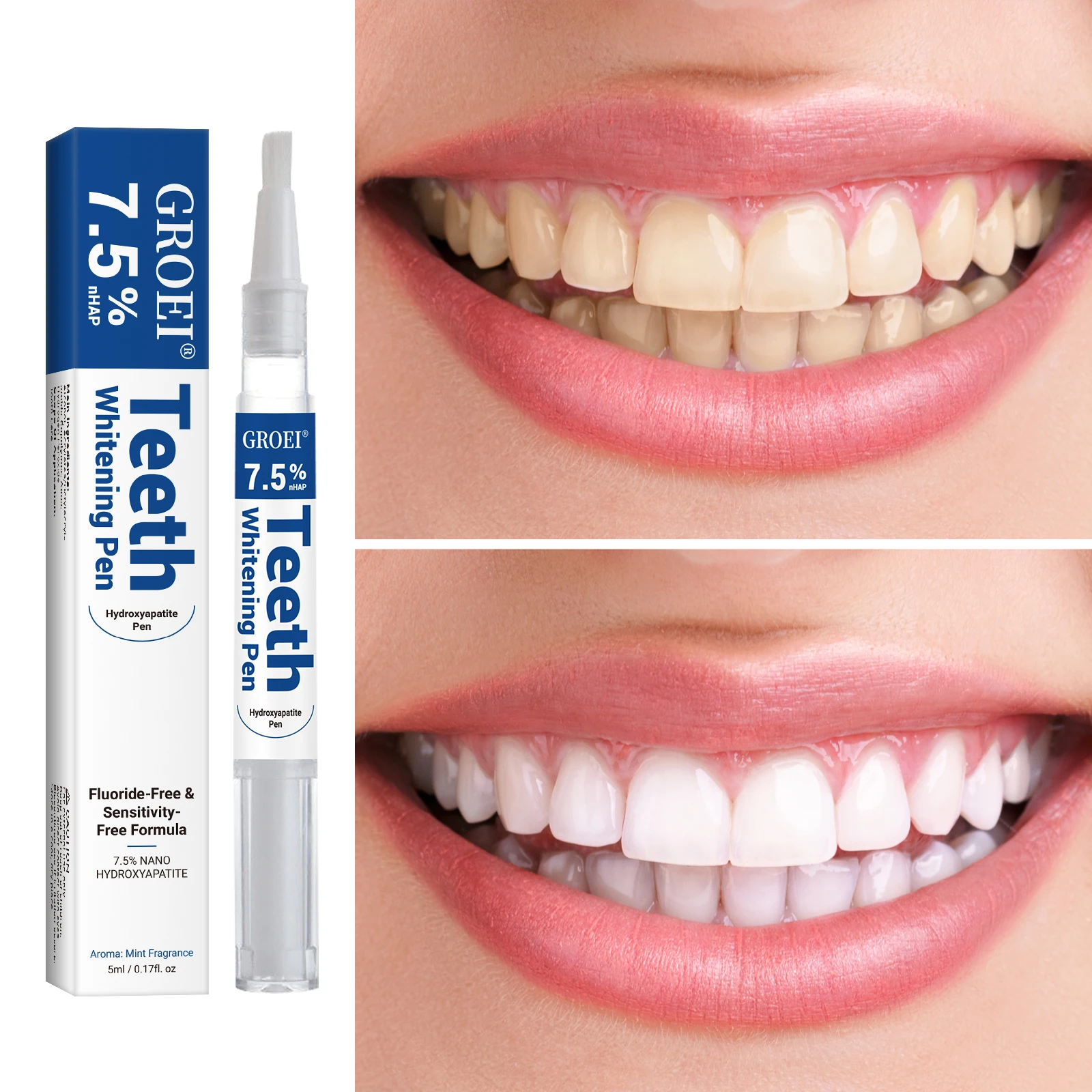 Hydroxyapatite Tooth Whitening - Teeth Whitening Results บทวิจารณ์และราคา