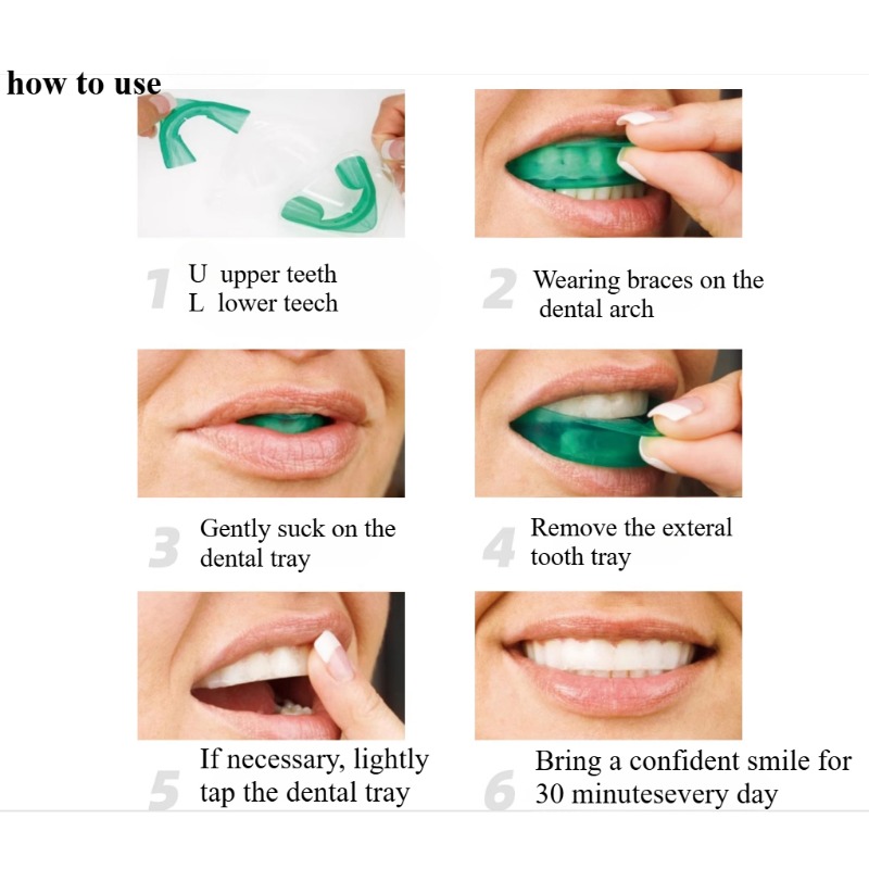 Set Teeth Whitening Tray U-sha - Teeth Whitening Results บทวิจารณ์และราคา