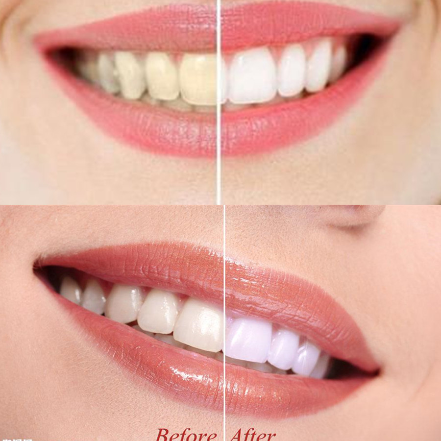 Bamboo Charcoal Teeth Tooth De - Teeth Whitening Co บทวิจารณ์และราคา