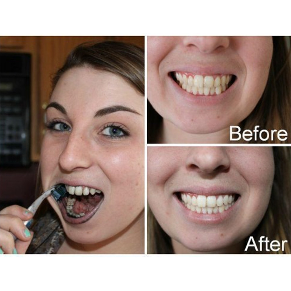 Bamboo Charcoal Teeth Tooth De - Teeth Whitening Co บทวิจารณ์และราคา
