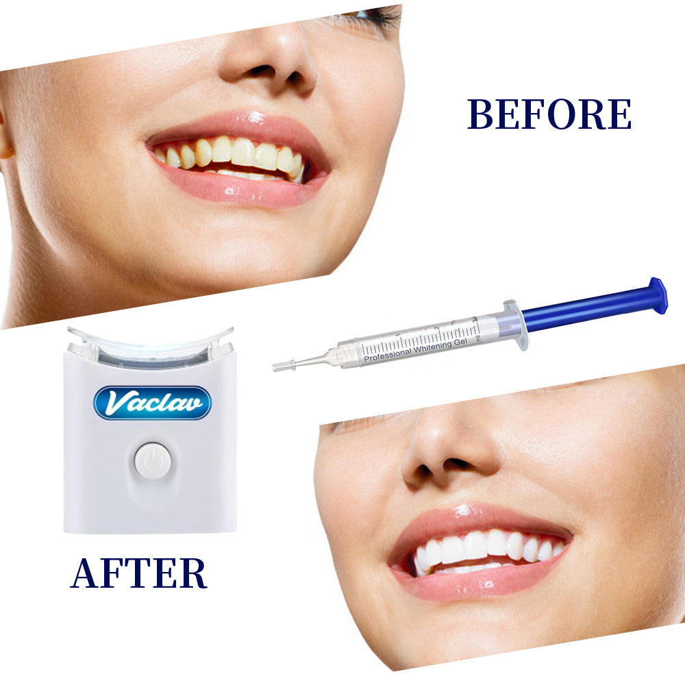 Mint Teeth Whitening Gel Syrin - Teeth Whitening Kit At Home บทวิจารณ์และราคา