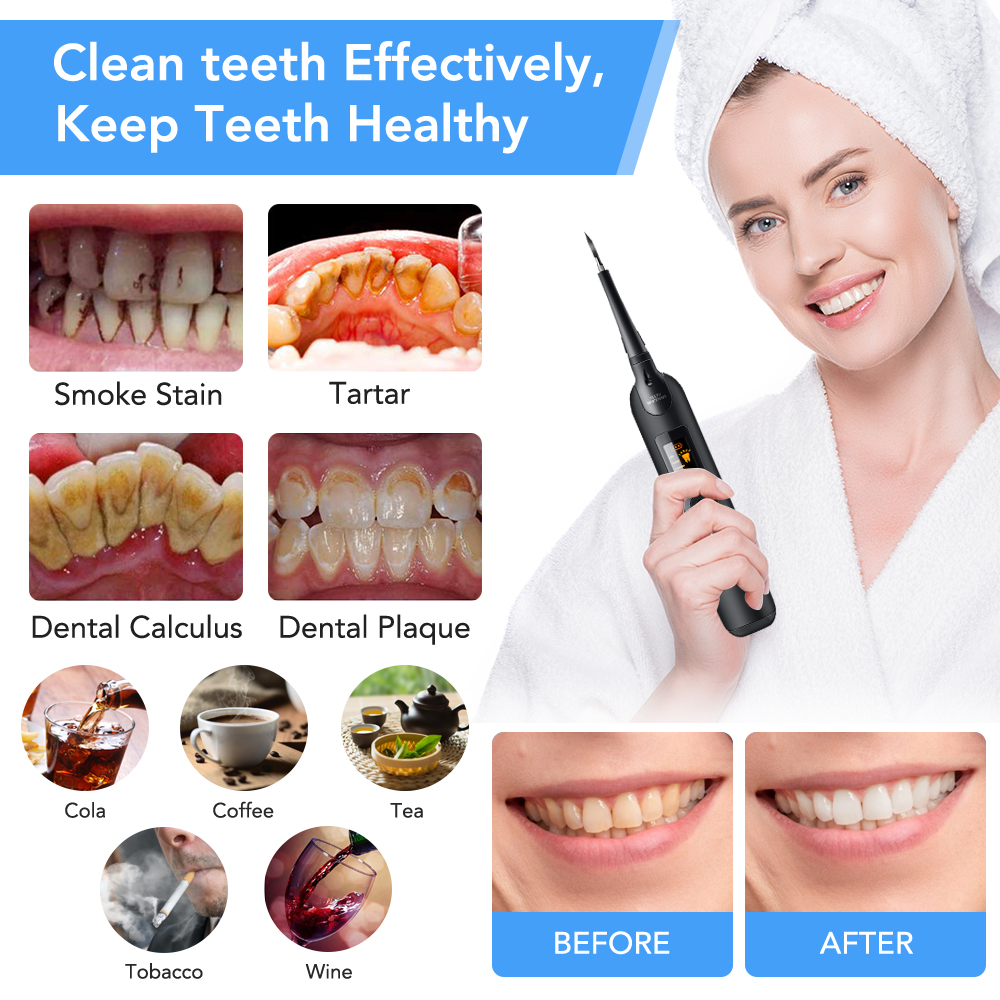 Teeth Tartar Remover Electric  - Teeth Whitening Kit At Home บทวิจารณ์และราคา