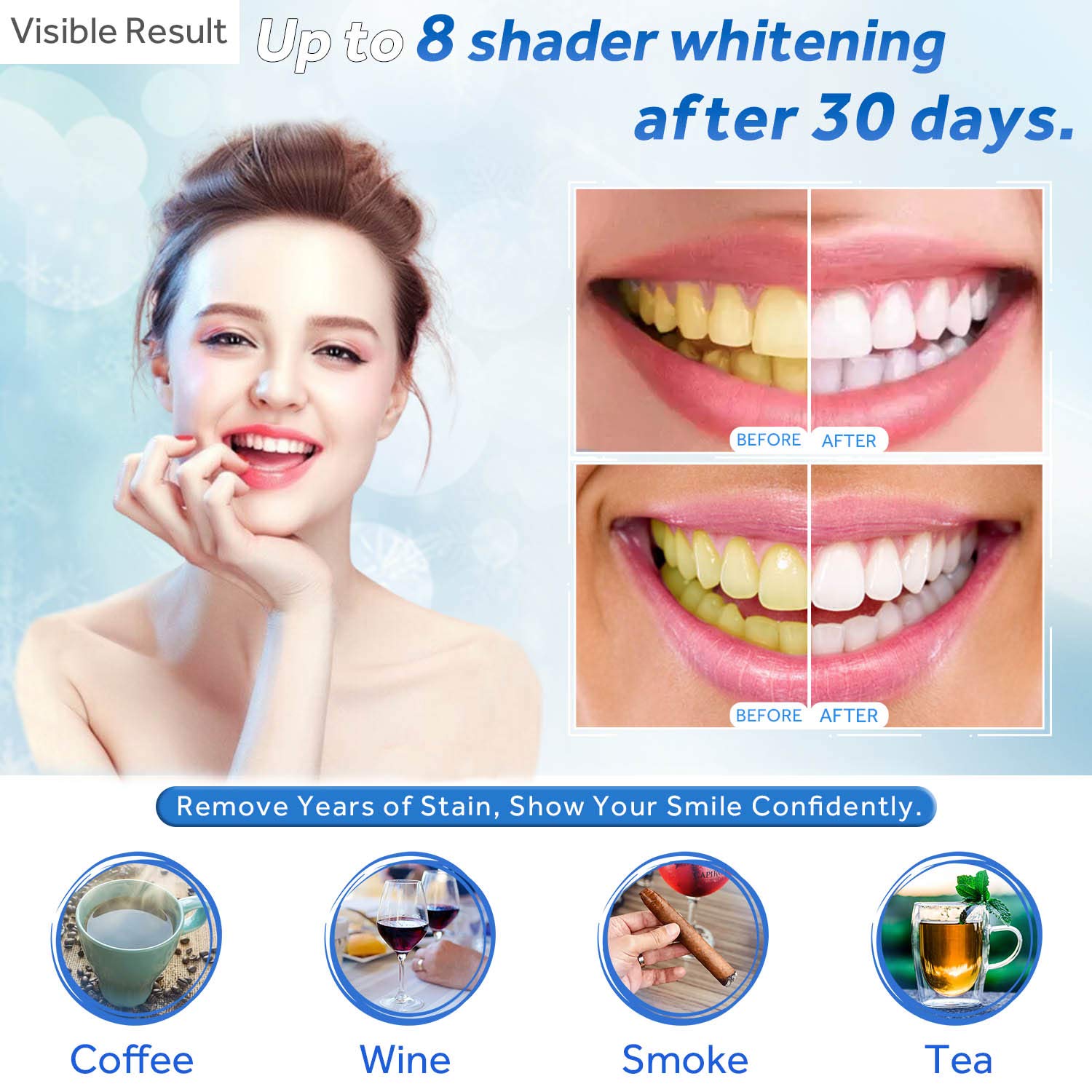 Teeth Whitening Gel Refill Syr - Teeth Whitening (Bleaching) บทวิจารณ์และราคา