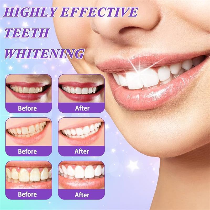 9D Purple Teeth Whitening Toot - Teeth Whitening That Works บทวิจารณ์และราคา
