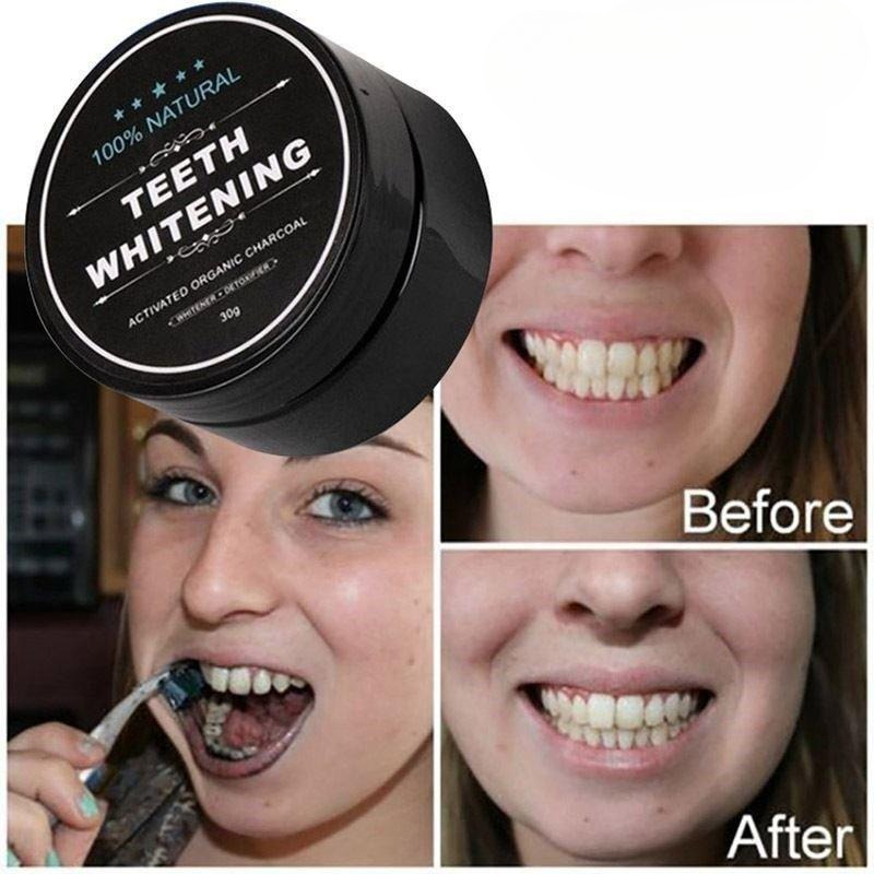 1 Box Activated Charcoal Teeth - Whitening Powder Activated บทวิจารณ์และราคา