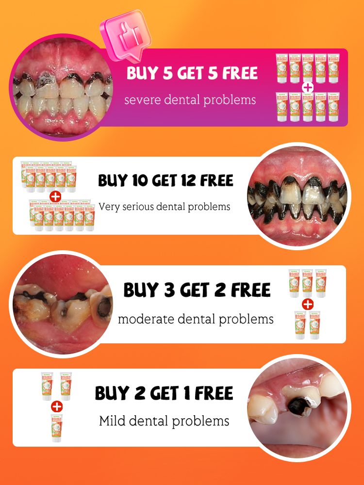 Repair tooth decay and whiten  - Teeth Whitening That Works บทวิจารณ์และราคา