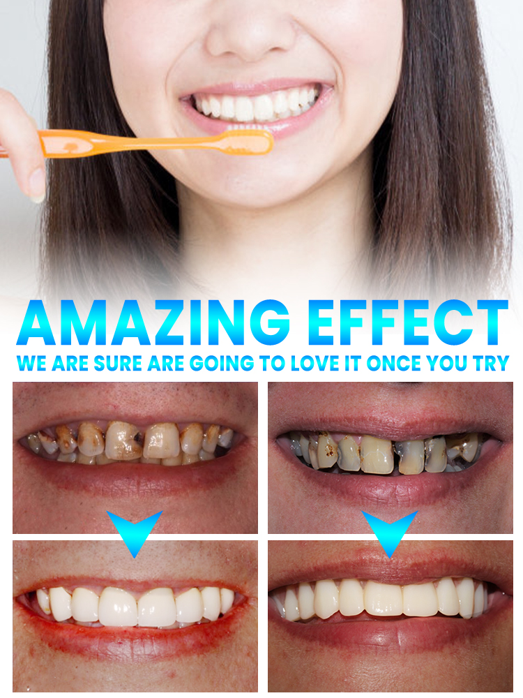 Repair tooth decay and whiten  - Teeth Whitening That Works บทวิจารณ์และราคา