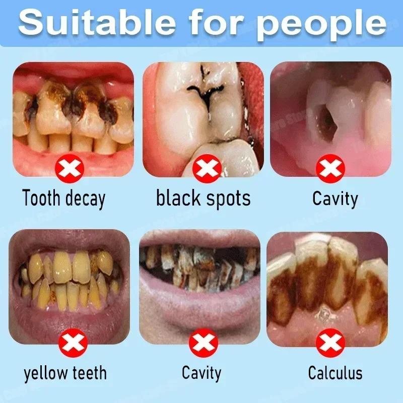 Anti Decay Toothpaste repairs  - Teeth Whitening That Works บทวิจารณ์และราคา