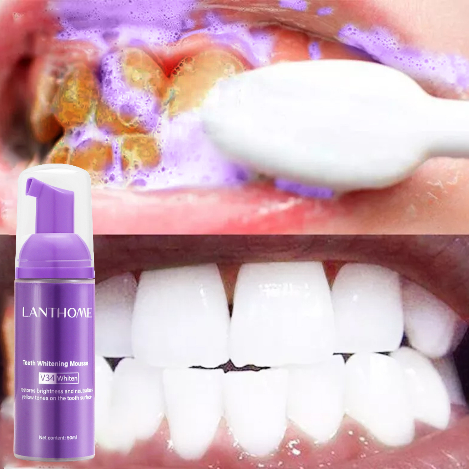 V34 Teeth Whitening Mousse Too - Teeth Whitening (Bleaching) บทวิจารณ์และราคา