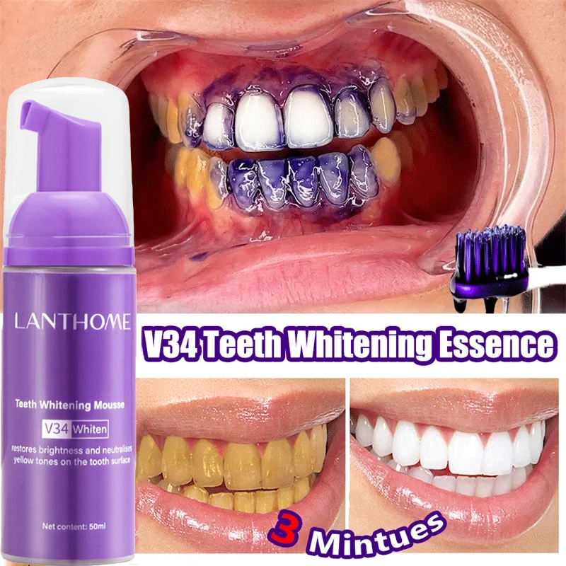 V34 Teeth Whitening Mousse Too - Teeth Whitening (Bleaching) บทวิจารณ์และราคา