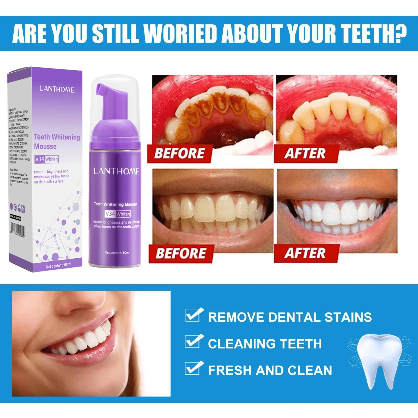 V34 Teeth Whitening Mousse Too - Teeth Whitening (Bleaching) บทวิจารณ์และราคา