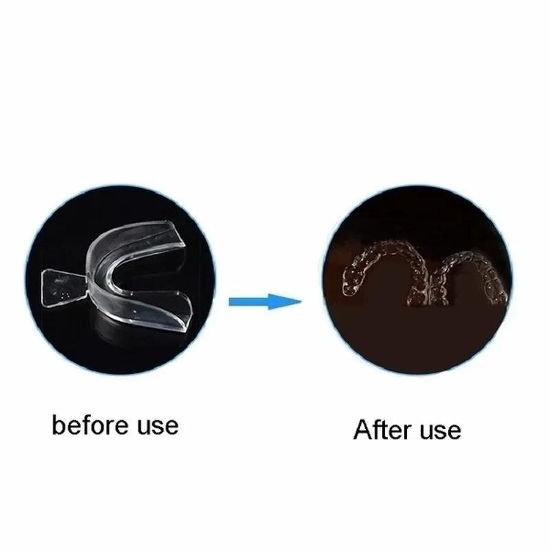 Professional Teeth Whitening T - Teeth Whitening Kit At Home บทวิจารณ์และราคา