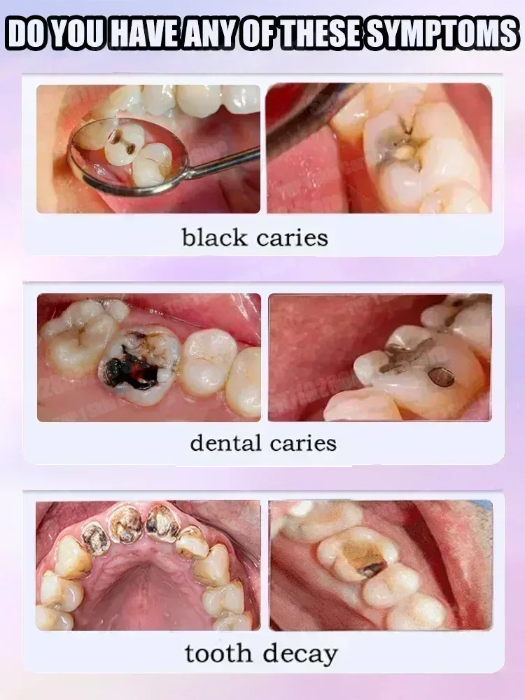 Hot sales Best-selling, Scient - Teeth Whitening That Works บทวิจารณ์และราคา