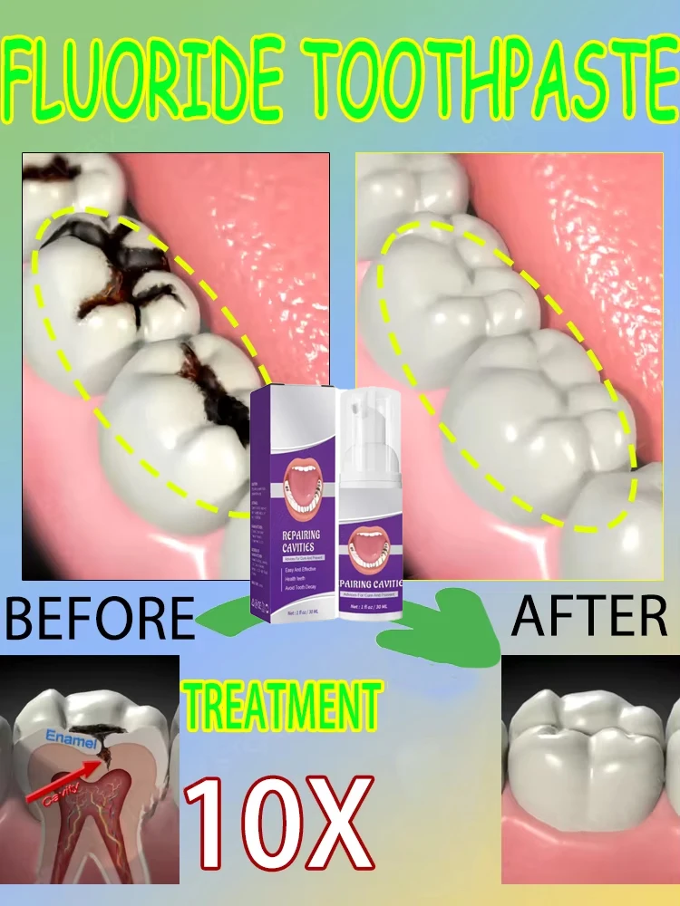 Hot sales Best-selling, Scient - Teeth Whitening That Works บทวิจารณ์และราคา