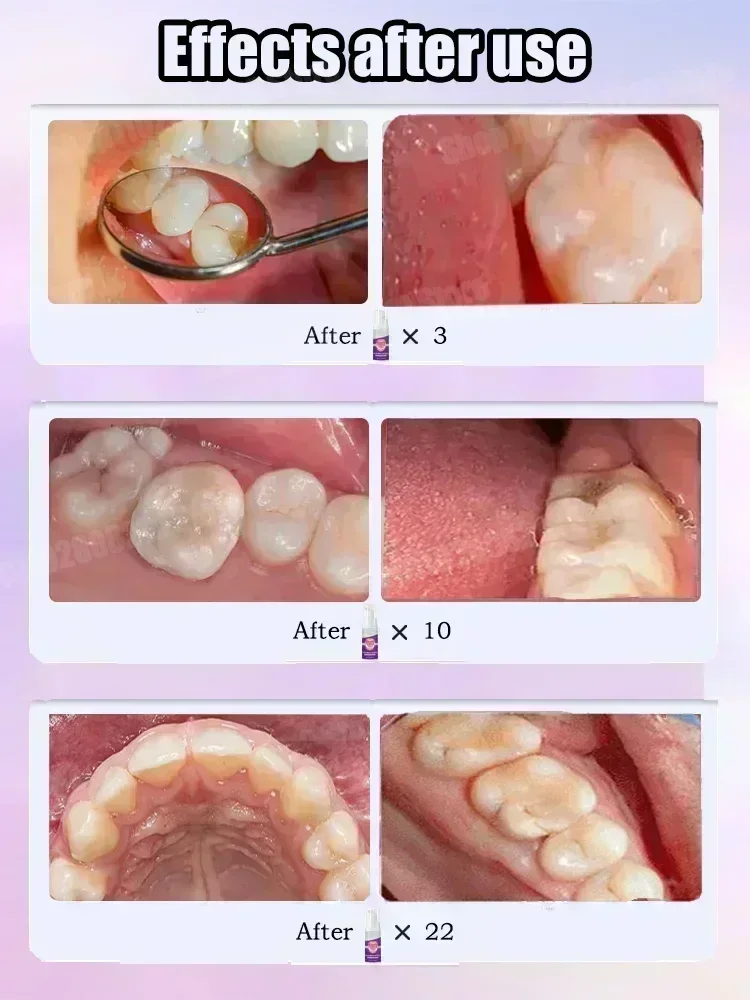 Hot sales Best-selling, Scient - Teeth Whitening That Works บทวิจารณ์และราคา