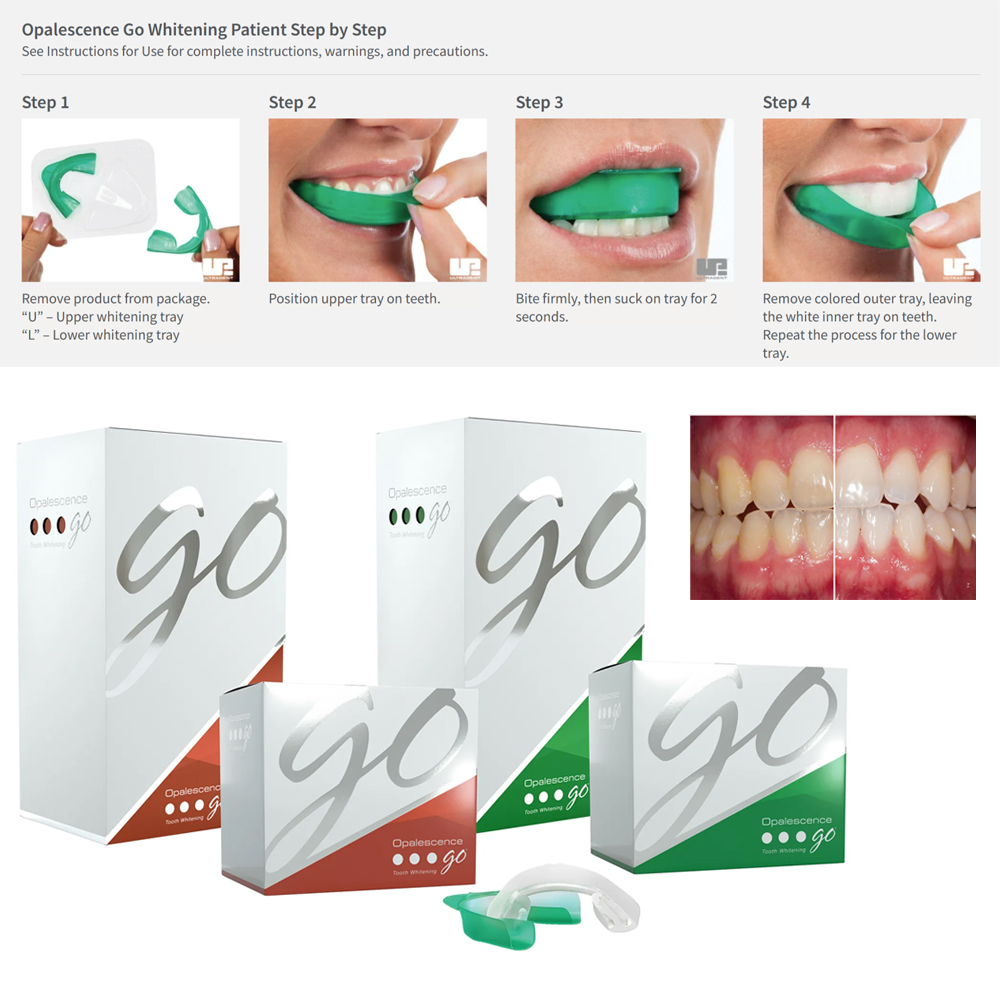 Opalescence Go Teeth Whitening - Teeth Whitening Kit At Home บทวิจารณ์และราคา