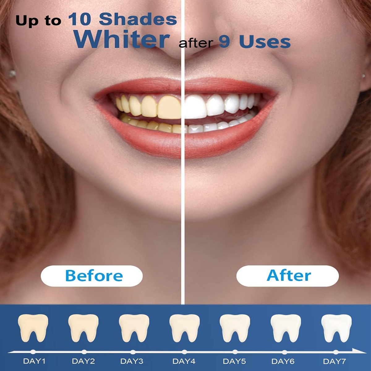 Teeth Whitening Kit - 5X LED L - Teeth Whitening Kit At Home บทวิจารณ์และราคา