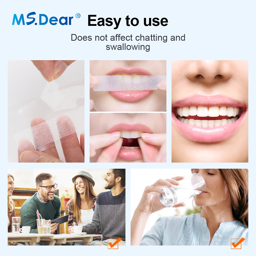 Teeth Whitening Strips Cleansi - Teeth Whitening Results บทวิจารณ์และราคา